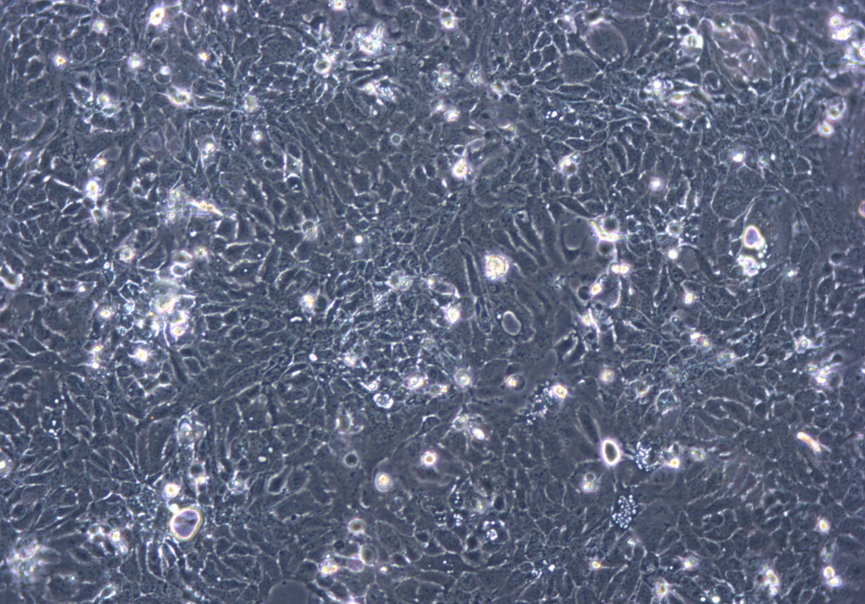 人膀胱癌细胞HT-1376(STR鉴定正确)