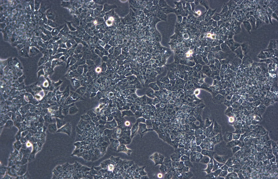 人乳腺导管癌细胞BT474(STR鉴定正确)