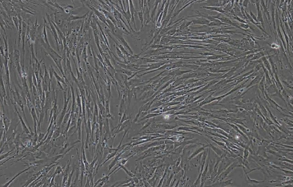 人肺成纤维细胞HFL1(STR鉴定正确)