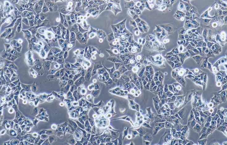 高转移人肝癌细胞MHCC97-H(STR鉴定正确)