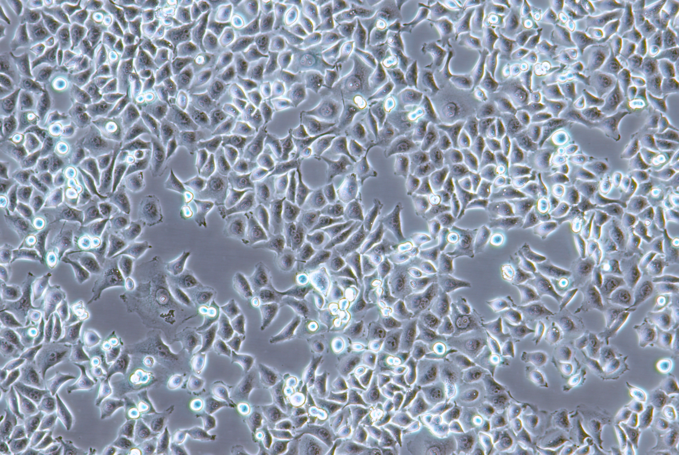 人涎腺腺样囊性癌细胞SACC-LM(STR鉴定正确)