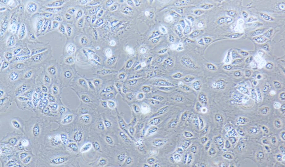 人肝癌细胞SNU-182(STR鉴定正确)