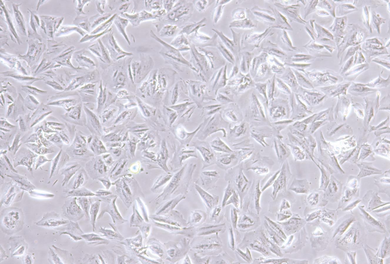 正常人结肠上皮细胞FHC(STR鉴定正确)