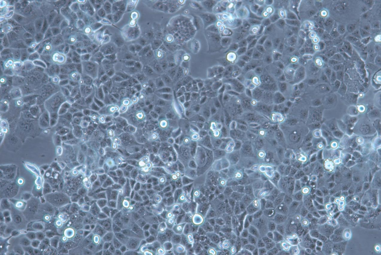 人子宫内膜癌细胞HEC-1-A(STR鉴定正确)