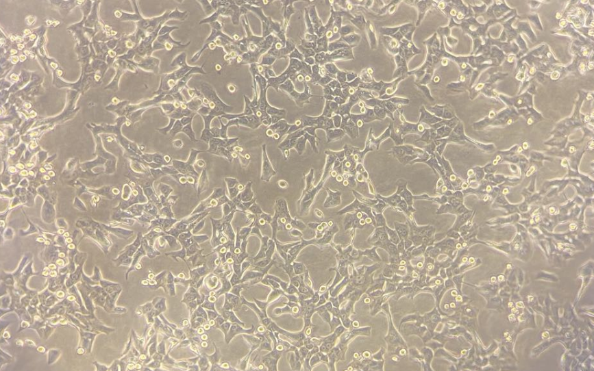 人肺癌腺癌细胞HCC4006   (STR鉴定正确)