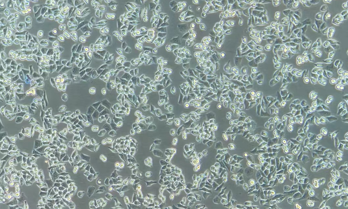 人子宫内膜腺癌(转移)细胞AN3CA(STR鉴定正确)